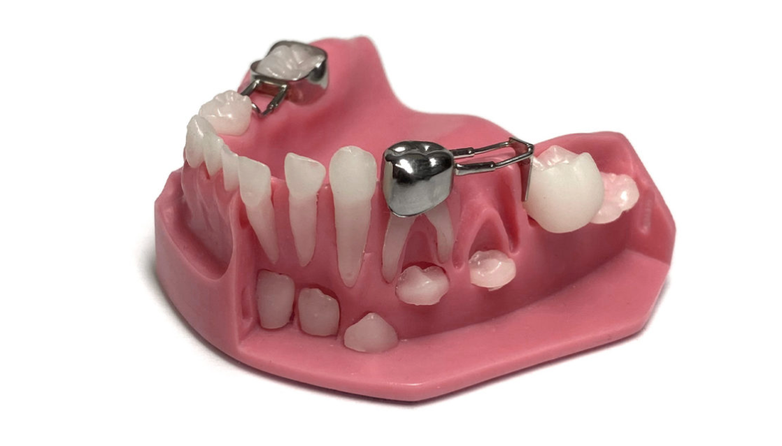 Model demonstarcyjny Denovo